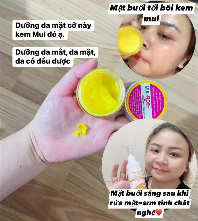 Dưỡng ẩm- Trị viêm da cơ địa, chàm sữa, nắm da.