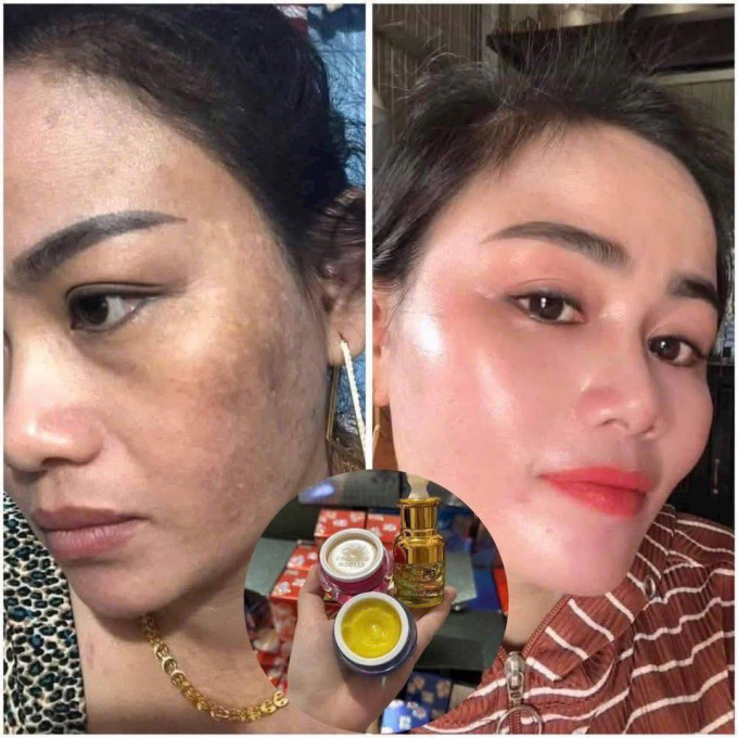 Hướng dẫn sử dụng