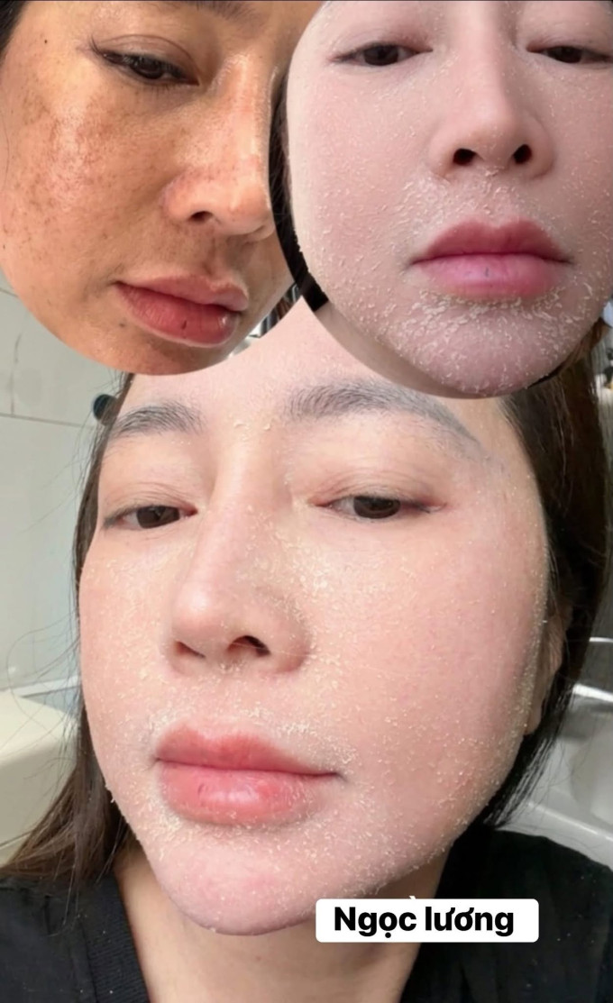 Lưu ý khi sử dụng
